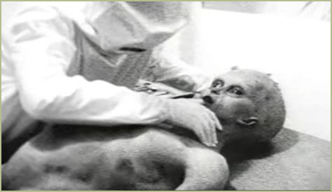 Alien Autopsy Photos: New Evidence Surfaces, Hoax or Reality?