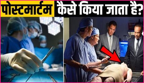 Autopsy Unveiled: What Secrets Do Post-Mortem Exams Hold?