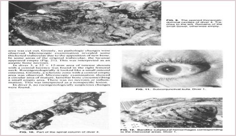 Byford Dolphin Autopsy: New Details Emerge? Report PDF Analysis