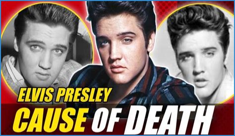 Elvis Autopsy Photos: The Vault, The Myths, and The Unseen Truth