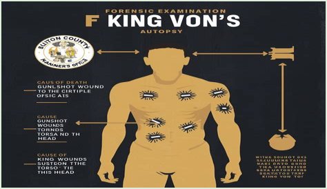 King Von Autopsy Smile: Disturbing Image or Misinformation?