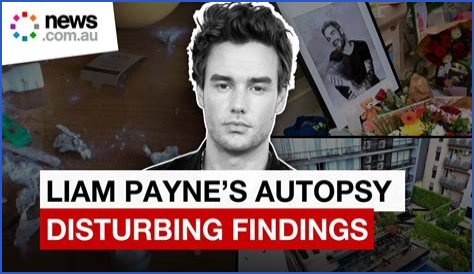 Liam Payne Autopsy Report: What the Leaked Docs Reveal