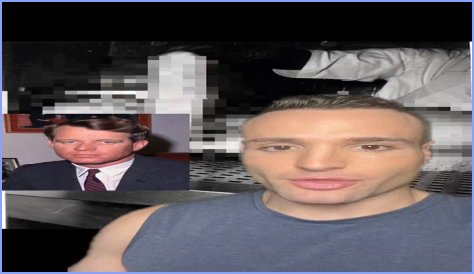 RFK Autopsy Photos: Conspiracy Fuel or Historical Record?