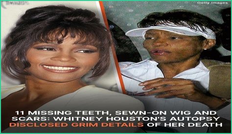 Whitney Houston Autopsy Photos: The Leaks, The Outrage, The Legacy