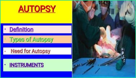 Y-Cut Autopsy: What It Reveals About Cause of Death